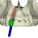 neodent