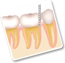periodontia-1