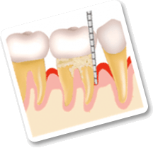 periodontia-2