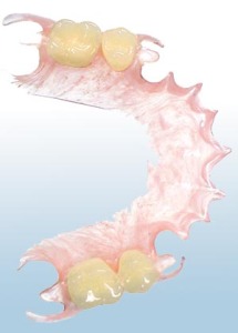 Deflex